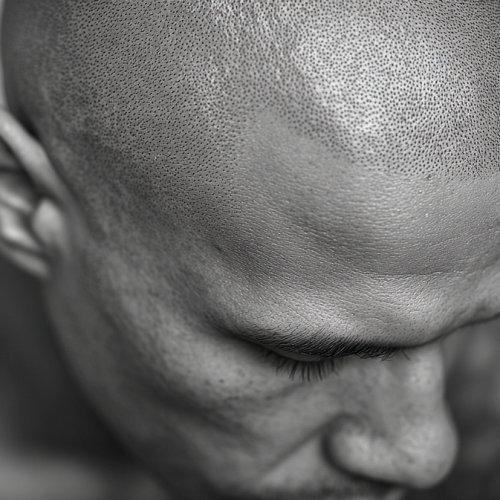 Mikropigmentacja skóry głowy: wszystko, co musisz wiedzieć przed zabiegiem